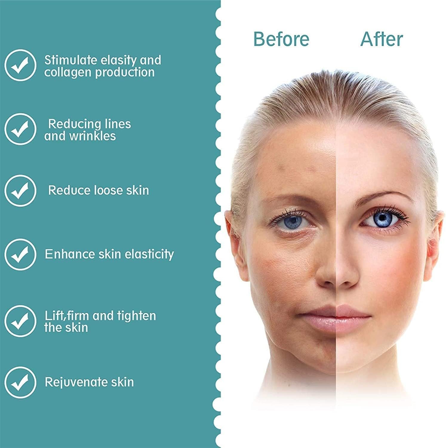 Mini HIFU Facial Lifting Device | جهاز الميني هايفو لشد البشرة والوجه - Image 4