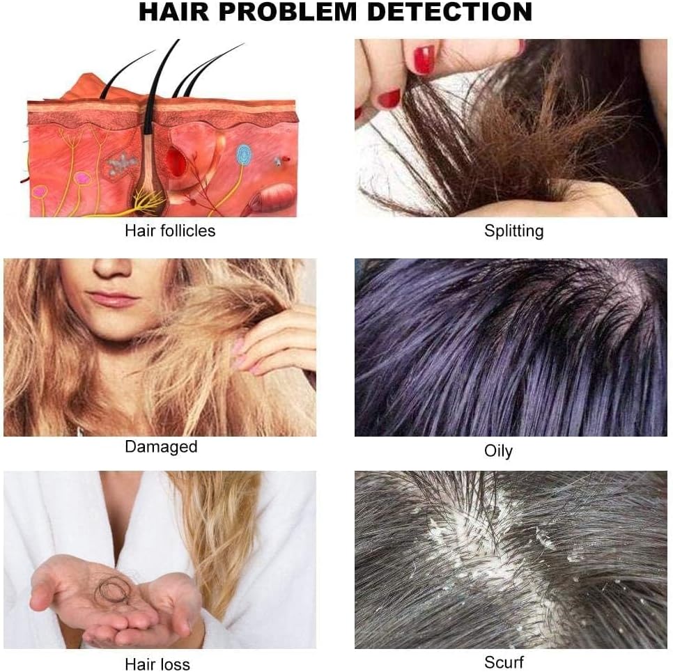 Skin & Hair Analyzer System | جهاز تحليل البشرة والشعر الاحترافي - Image 3