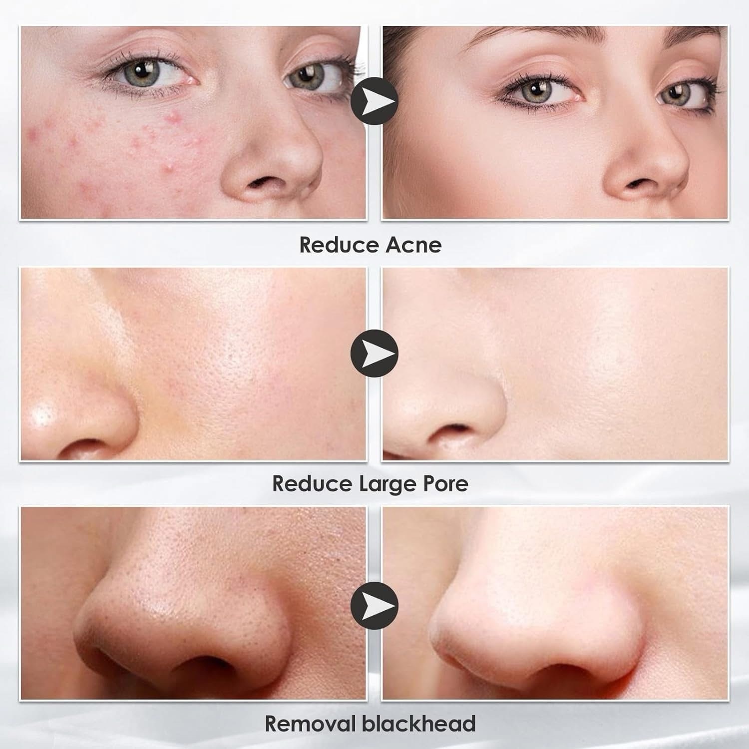 جهاز التقشير الماسي المنزلي مع رؤوس التقشير لتقشير وتنظيف البشرة | Diamond Microdermabrasion Home Device - Image 3