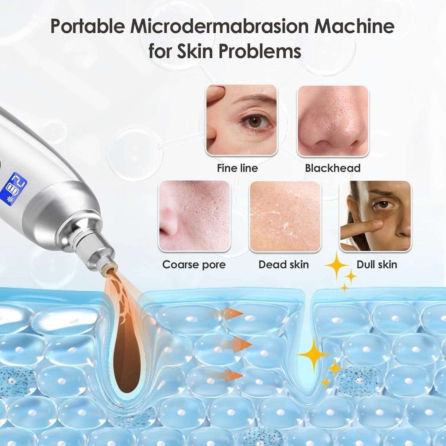 جهاز التقشير الماسي المنزلي مع رؤوس التقشير لتقشير وتنظيف البشرة | Diamond Microdermabrasion Home Device - Image 7