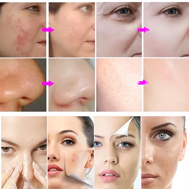 جهاز أوكسجينوا 3 هيد مع كابسولات Oxygeneo الأصلية | Oxygeneo 3 Heads Facial Machine - Image 9