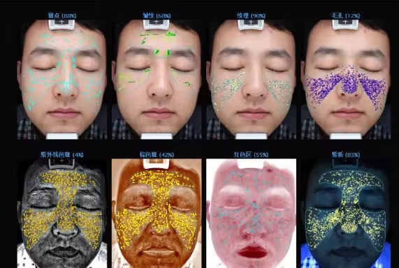 3D AI Facial Skin Analyzer – جهاز تحليل البشرة الذكي 3D بتقنية الـ8 أطياف وكاميرا 28MP | Smart Skin Diagnostic Machine - Image 5