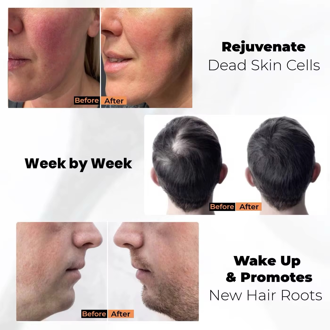 Derma Stamp Microneedling – أداة المايكرونيدلينج الاحترافية للبشرة والشعر - Image 5