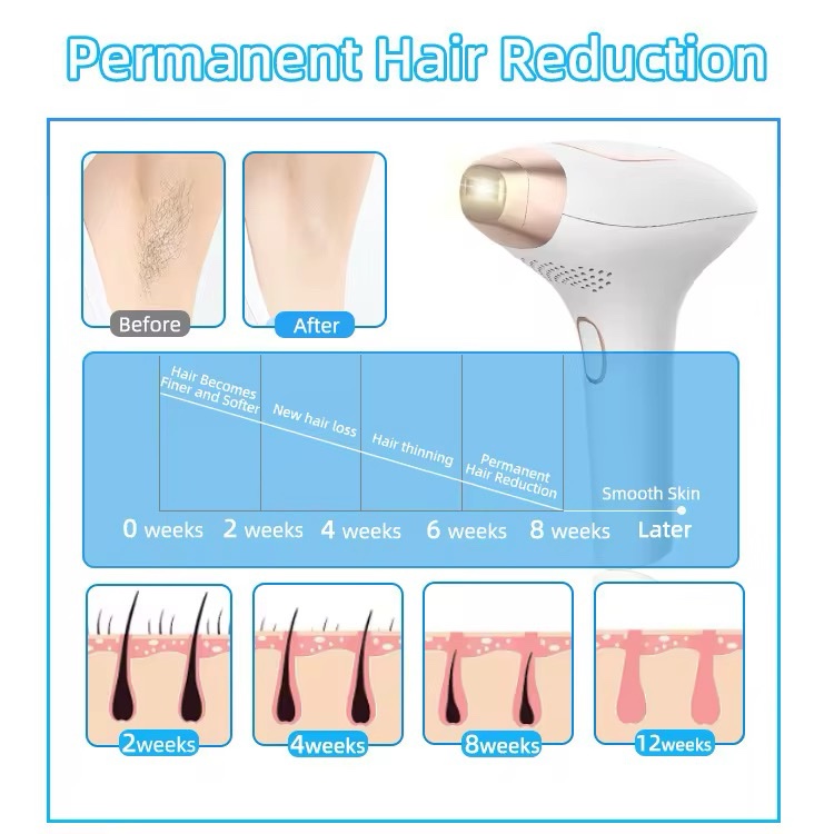 جهاز ازاله الشعرIPL Hair Removal 9000 - Image 7