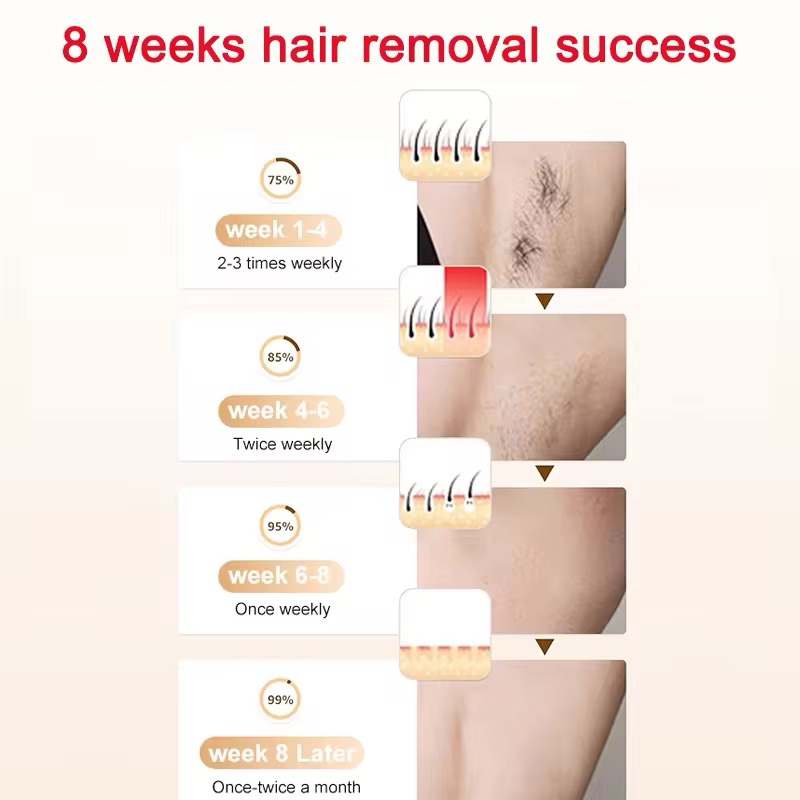 جهاز ازاله الشعرIPL Hair Removal 9000 - Image 10