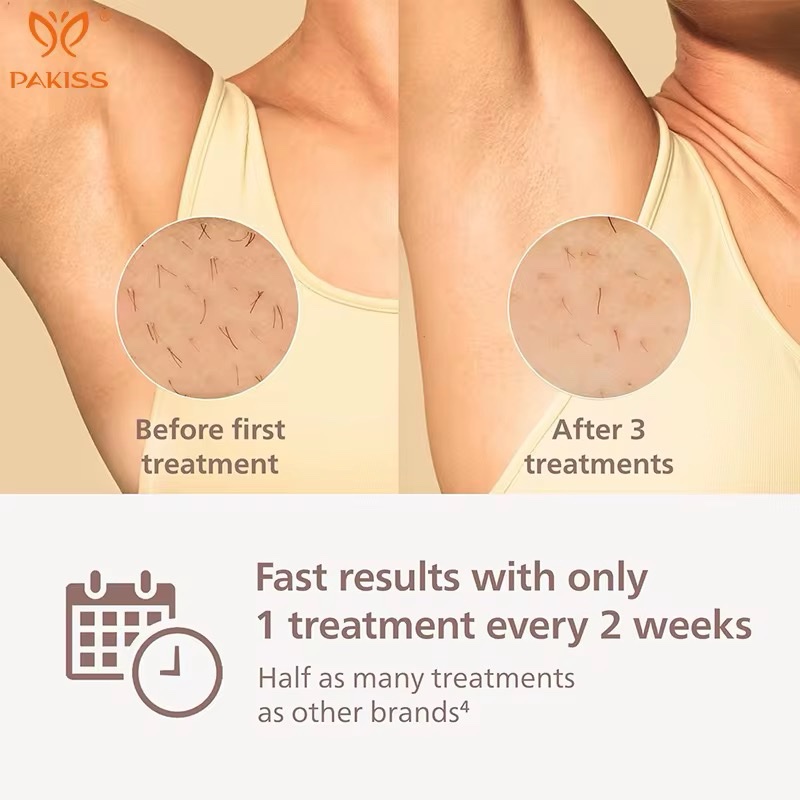 جهاز ازاله الشعرIPL Hair Removal 9000 - Image 5