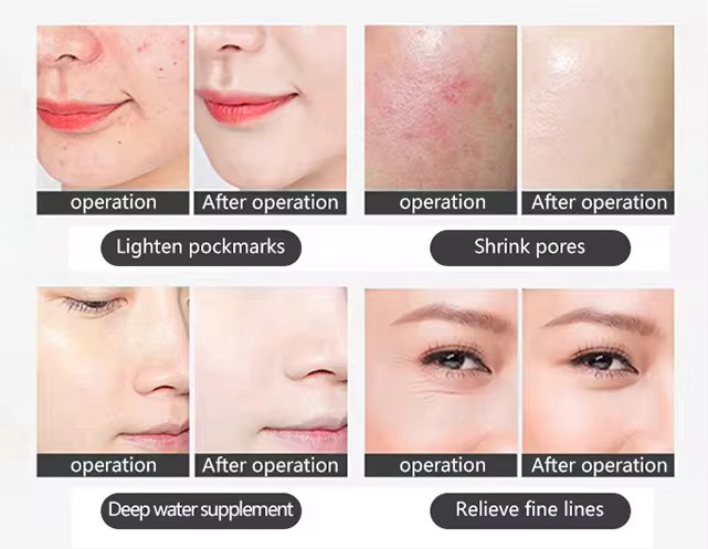 أوميجا لايت بالبخار | Omega Light Steam LED Therapy System - Image 5